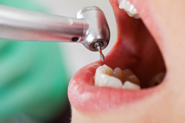 Best Pediatric Emergency Dentist in Granite Hills, CA